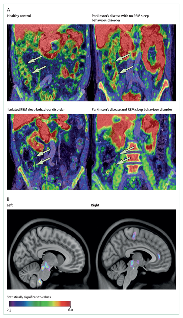 Figure 2: