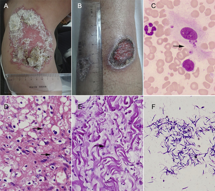 Fig 3