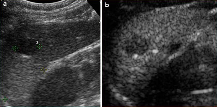 Fig. 10