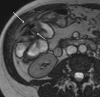 Fig. 15