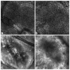 Fig. 13