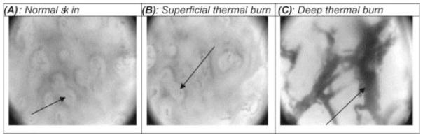 Fig. 12