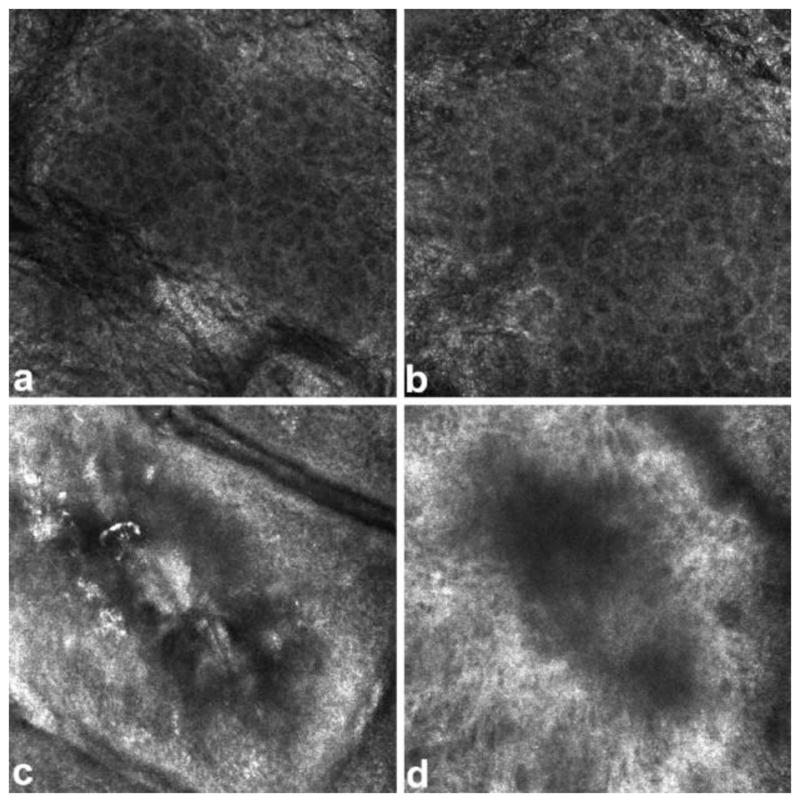 Fig. 13