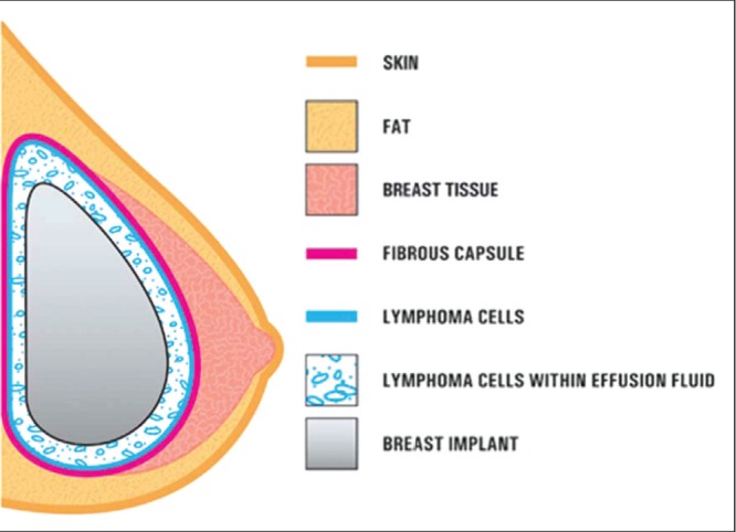 Figure 3)