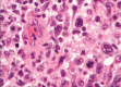 Figure 2)