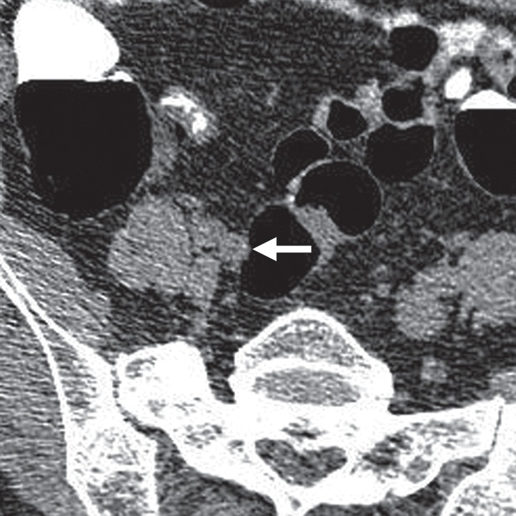 Figure 17b