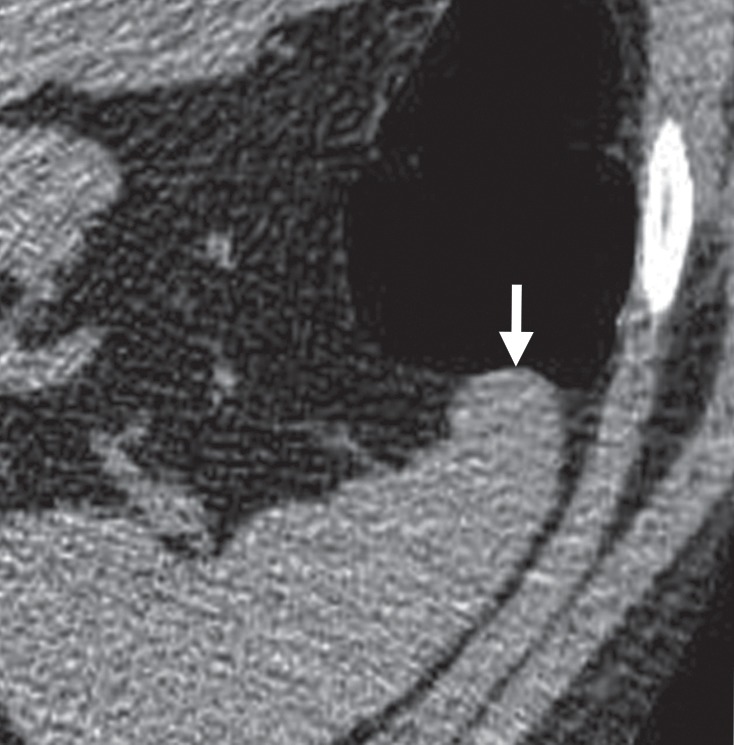 Figure 18b