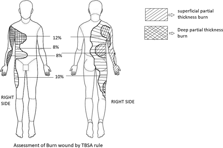 Fig. 1