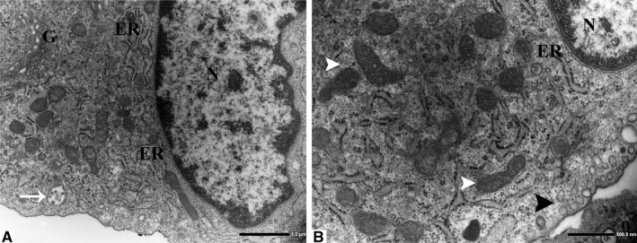 FIGURE 3