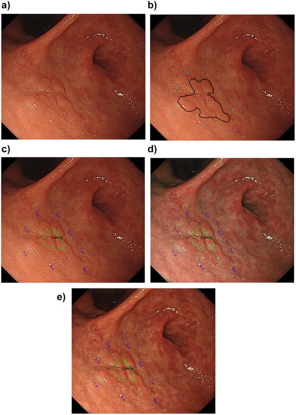 FIGURE 2