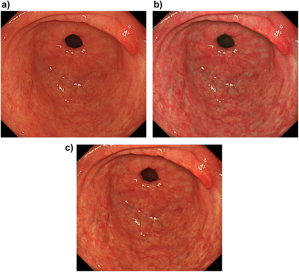 FIGURE 4