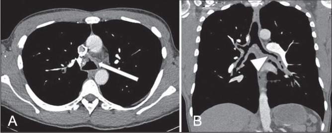 Figure 1)