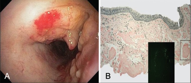 Figure 2)