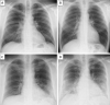 Fig. 4