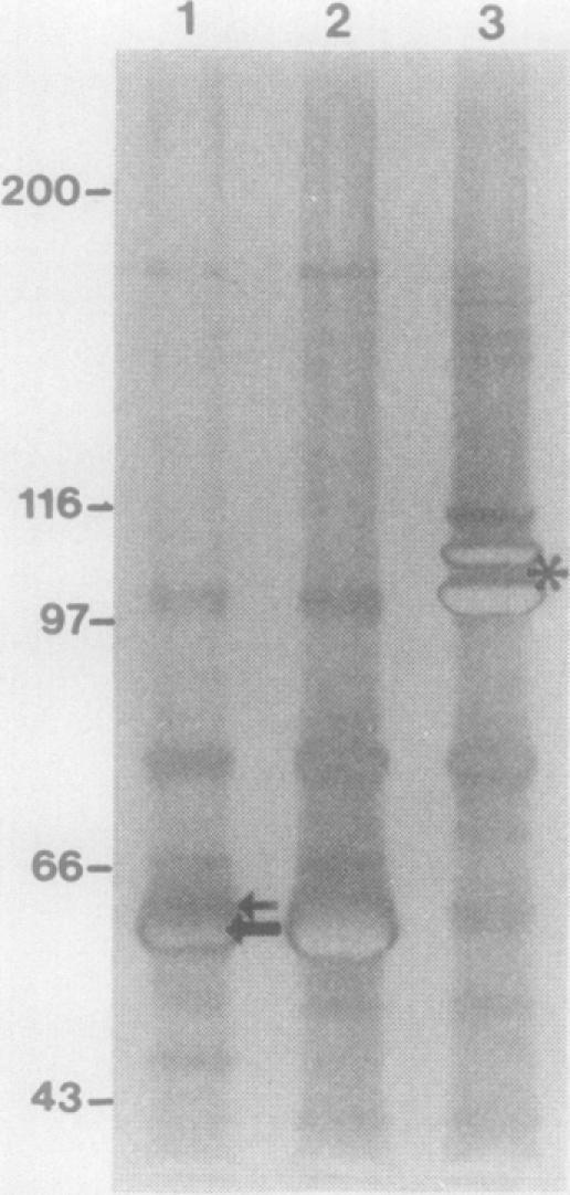 FIG. 11