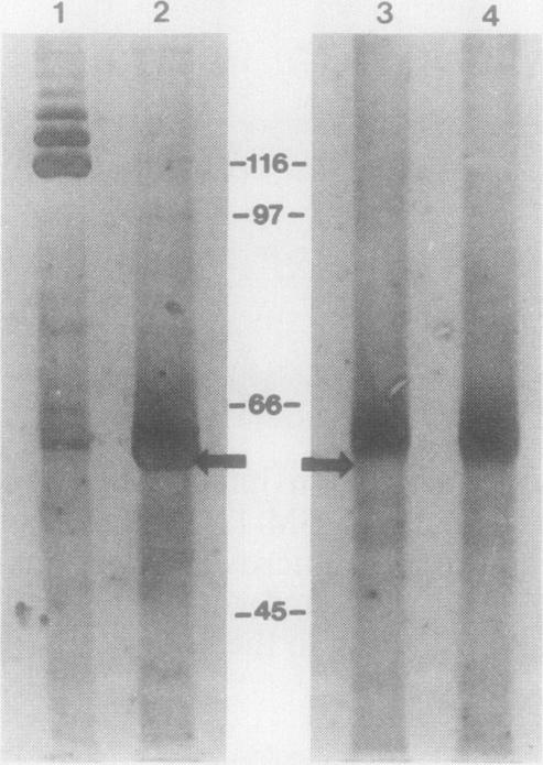 FIG. 12