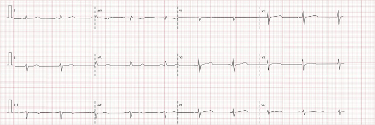 Figure 3