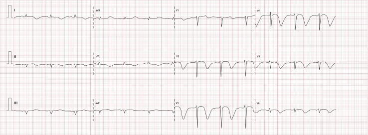 Figure 1