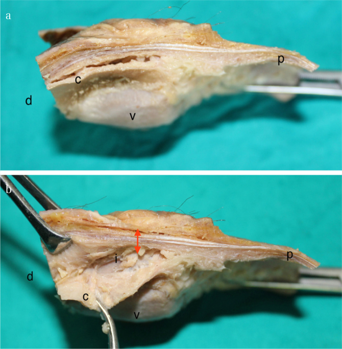 Figure 2. a, b