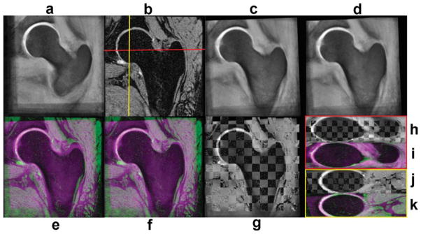 FIG. 8