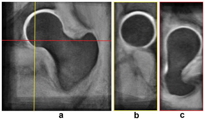 FIG. 3