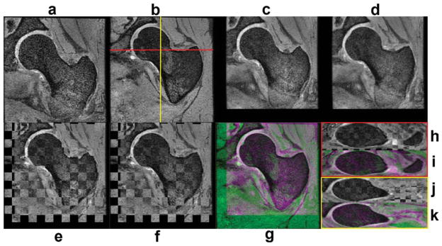 FIG. 1