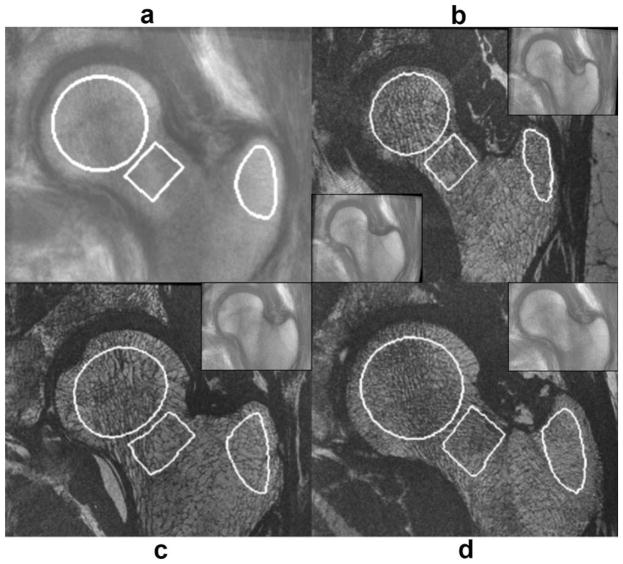 FIG. 9