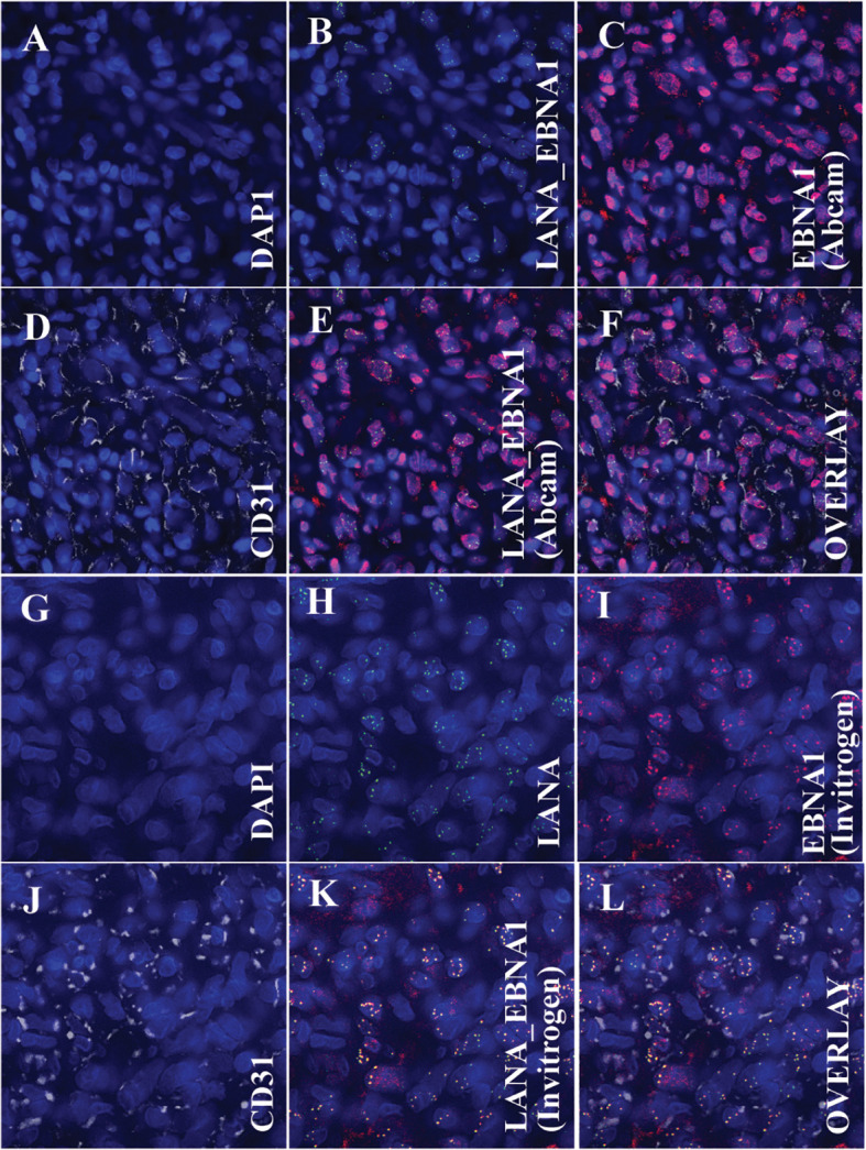 Figure 4