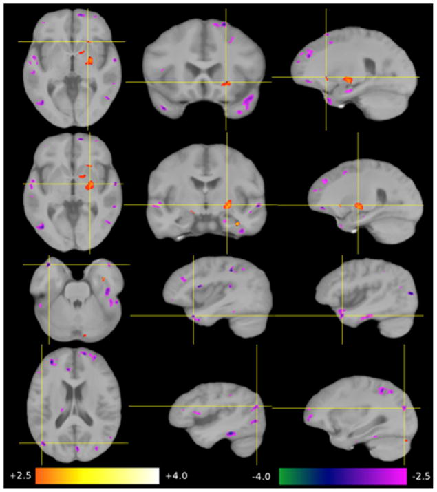 Fig. 4