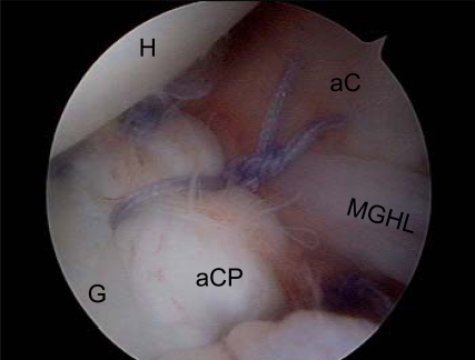 Fig (3).