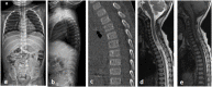 Fig. 11