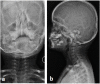 Fig. 12