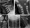 Fig. 15