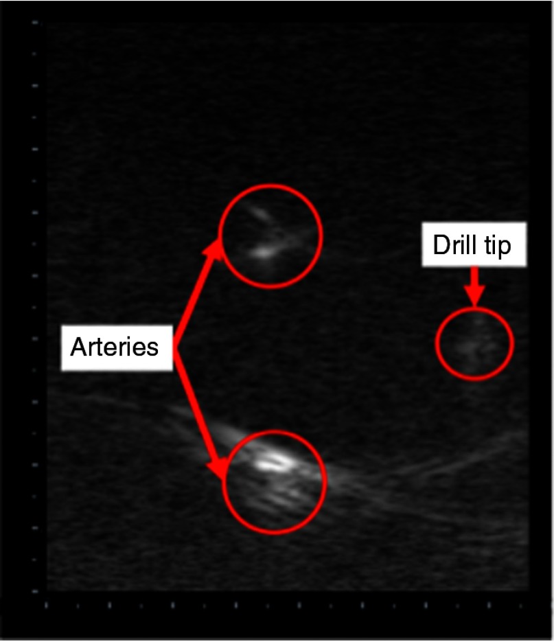 Fig. 15