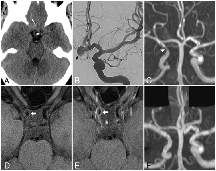 FIG. 3.