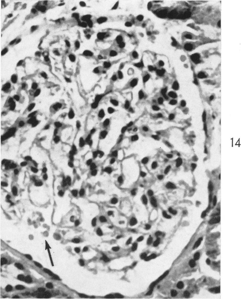 Fig. 14