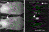 Fig. (5).