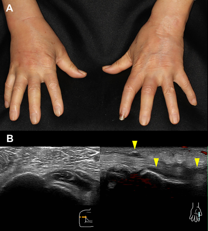 Figure 1