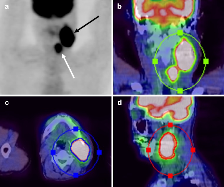 Fig. 1