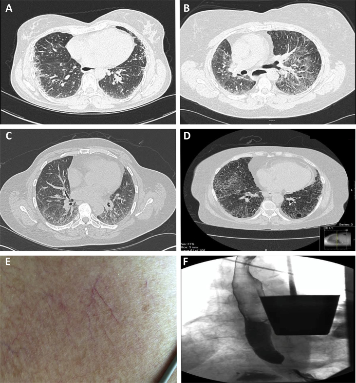 Fig. 1