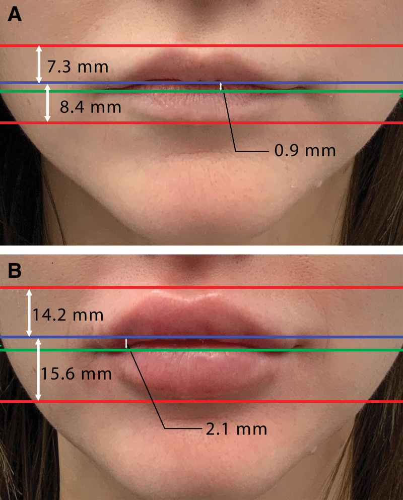 Fig. 3.