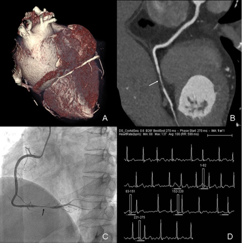 Fig 4