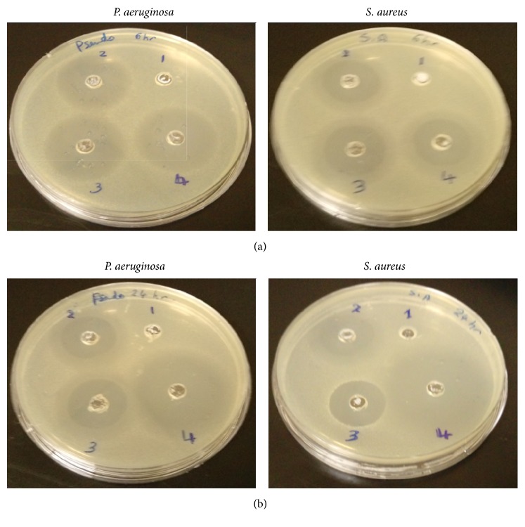 Figure 11