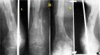 Fig. 3-D