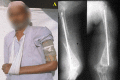 Fig. 4-A