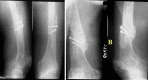 Fig. 5-B