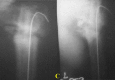 Fig. 1-C
