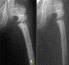 Fig. 1-A