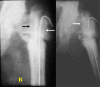 Fig. 1-B
