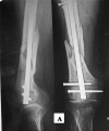 Fig. 3-A